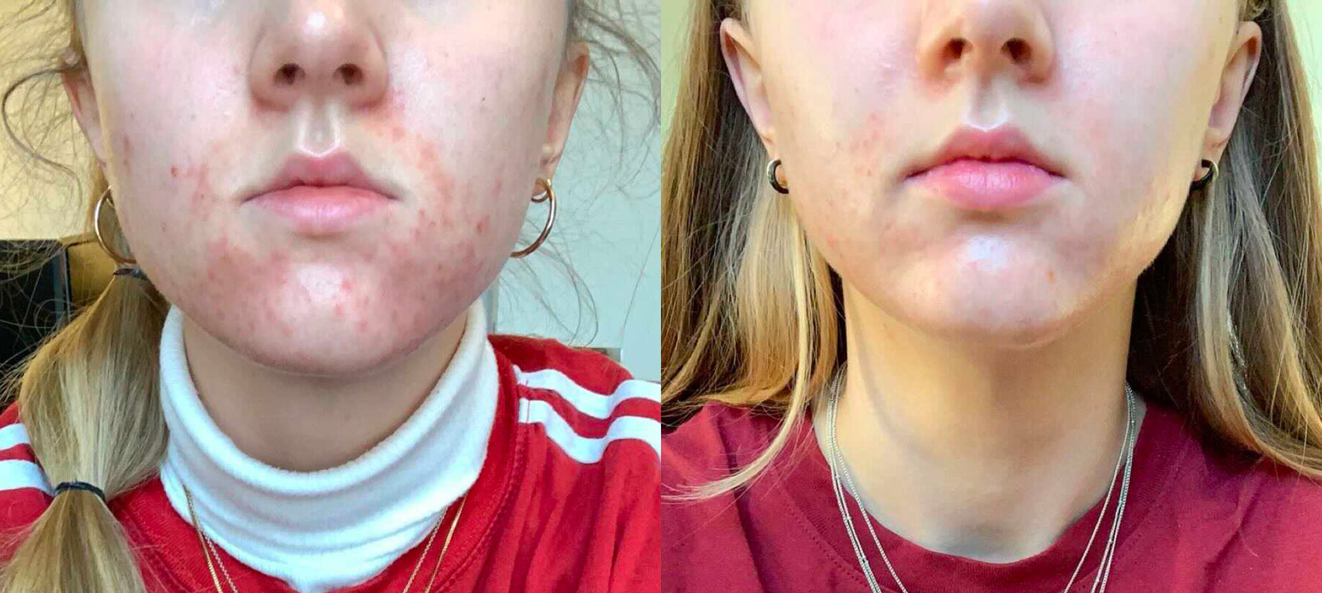 lisashistorie_koreansk-hudpleie_skinsecret