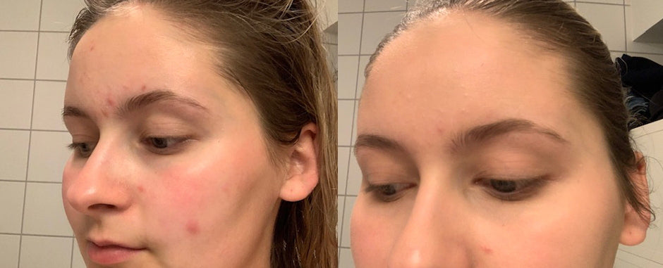 forogetterskinsecret