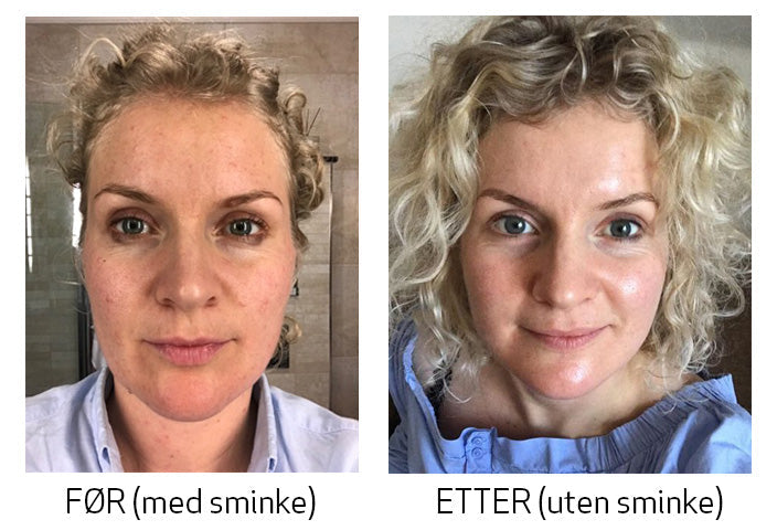 koreansk-hudpleie-før-og-etter-skinsecret