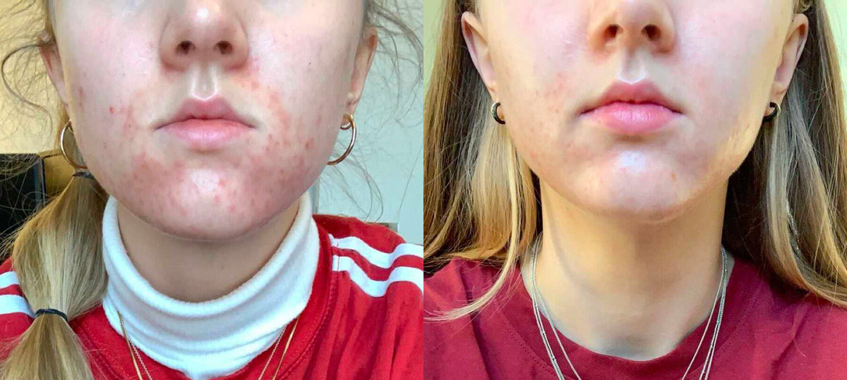 lisashistorie_koreansk-hudpleie_skinsecret