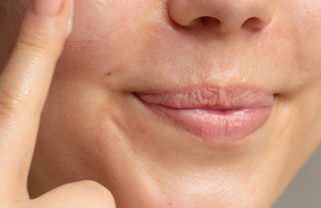 SkinSecret